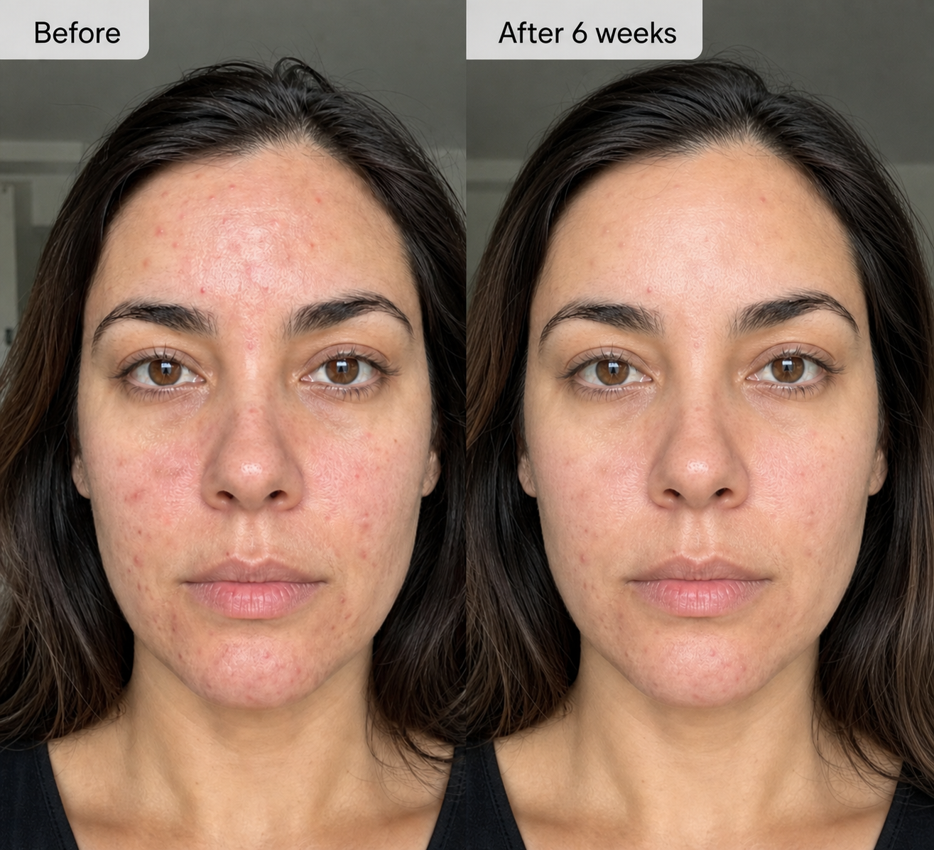 Máscara Facial LED 7 Cores