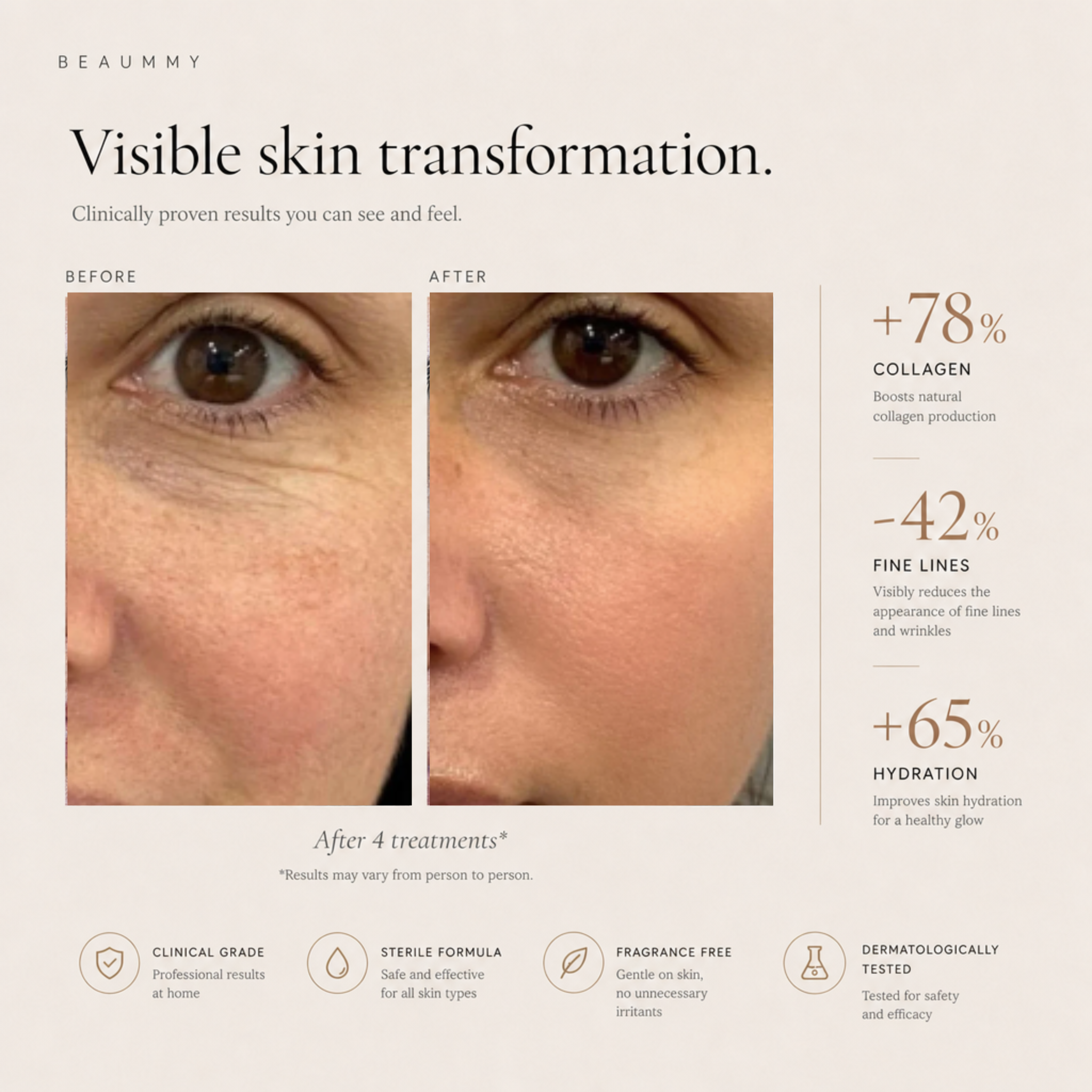 Microneedling Infusion Kit